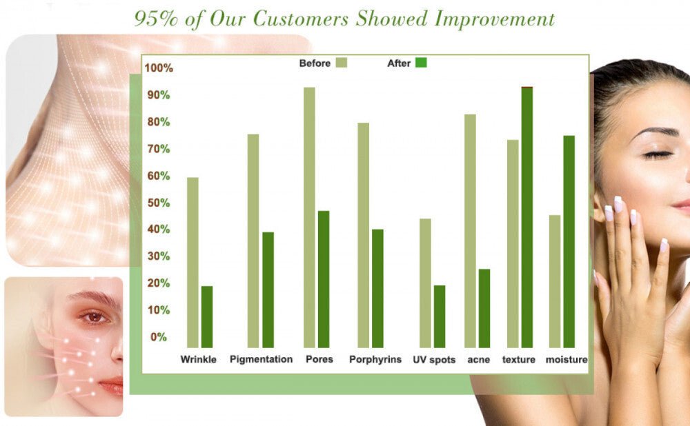 7 Színű LED arc - És Nyakmaszk, Fényterápiás Aknekezelő És Bőrfiatalító Eszköz - BShopy