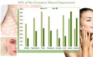 7 Színű LED arc - És Nyakmaszk, Fényterápiás Aknekezelő És Bőrfiatalító Eszköz - BShopy